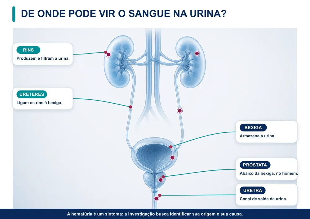 Sangue na urina: de onde pode vir?