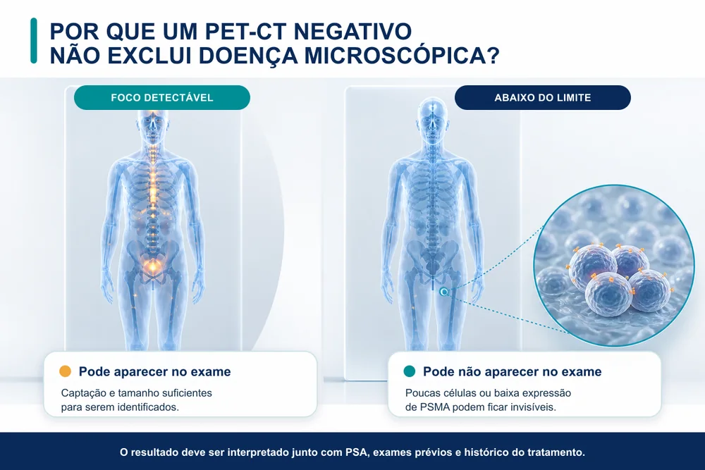 PET-CT com PSMA no Câncer de Próstata: Quando o Exame Faz Diferença?