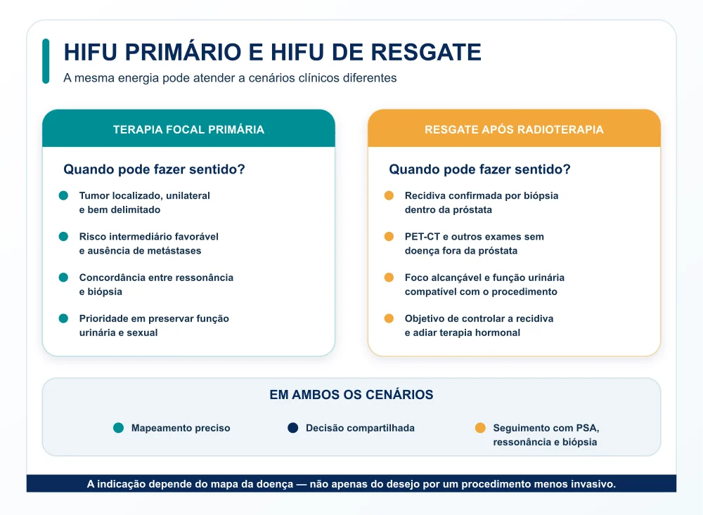 Infográfico compara critérios para terapia focal primária com HIFU e HIFU de resgate após radioterapia.